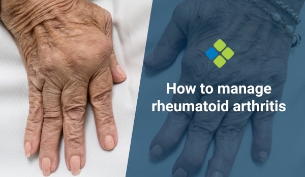 How to manage rheumatoid arthritis